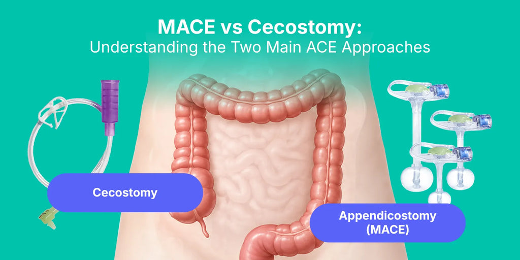 MACE vs Cecostomy