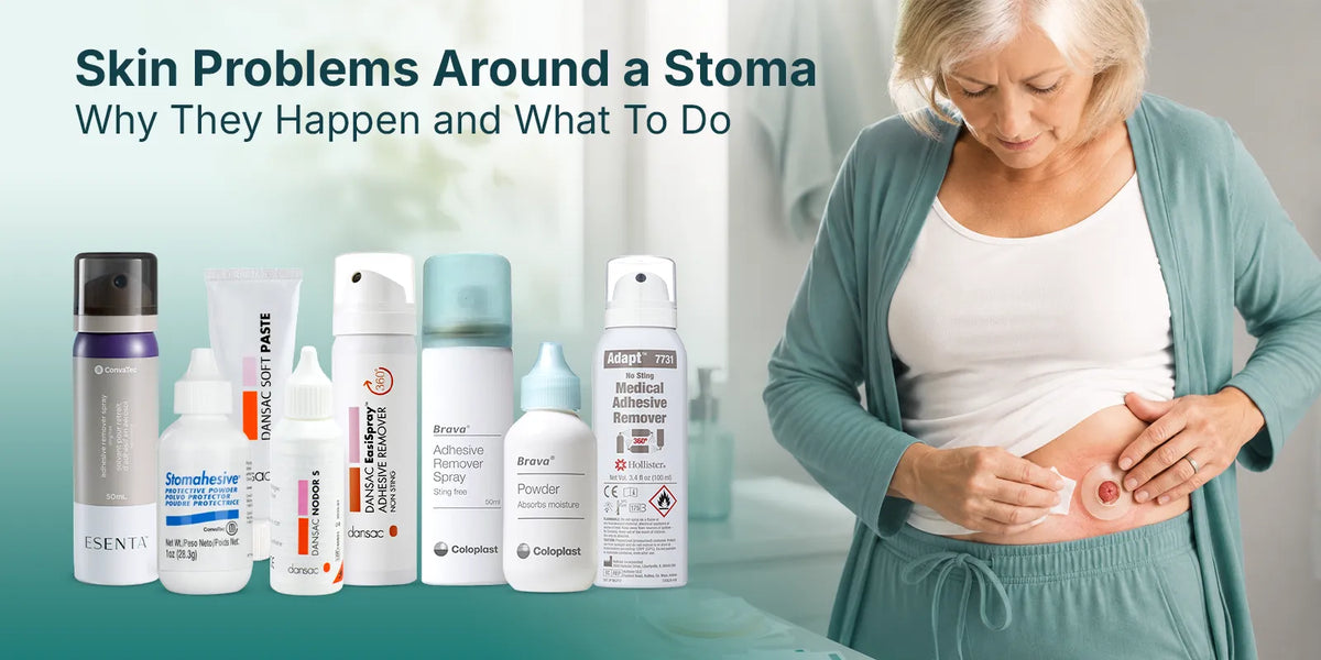 Skin Problems Around a Stoma: Why They Happen and What To Do About Them