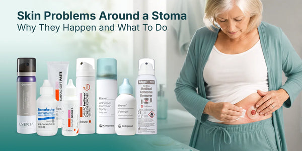 Skin Problems Around a Stoma: Why They Happen and What To Do About Them