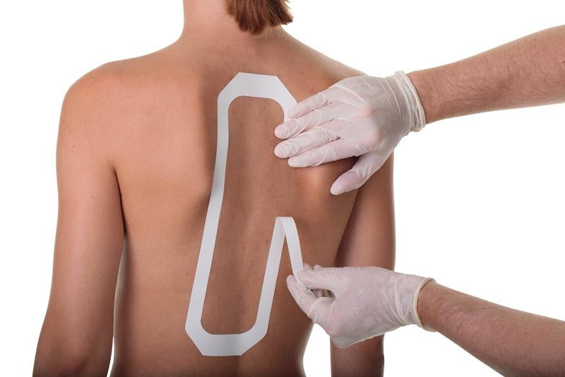 Medstock Transparent Film one box sizes: 6cm / 10cm /