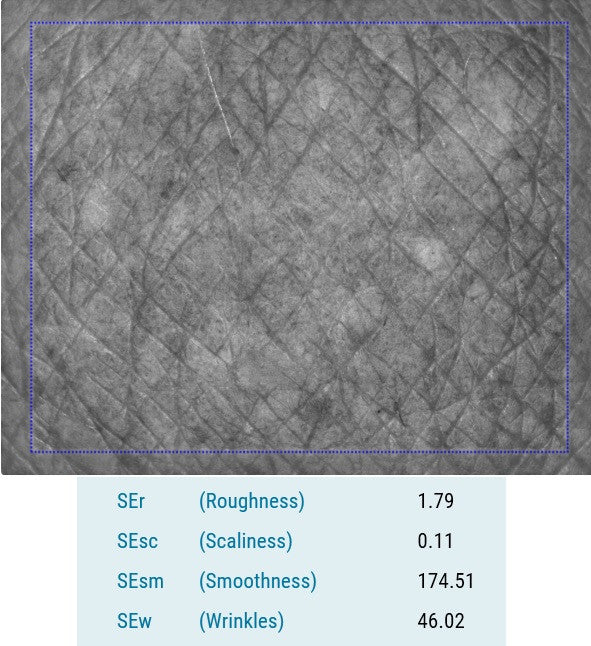 Visioscan VC 20plus Skin Topography Directly Measured with the Multi