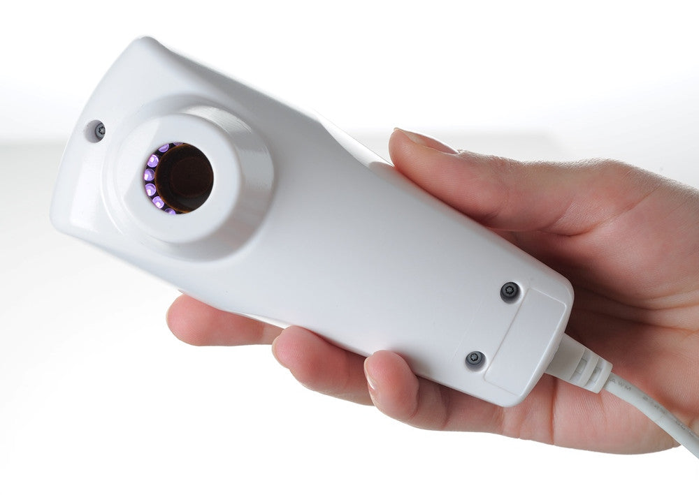 Visiopor PP 34 N Monitoring Acne Lesions by Skin Fluorescence