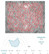 Visioscan VC 20plus Skin Topography Directly Measured with the Multi