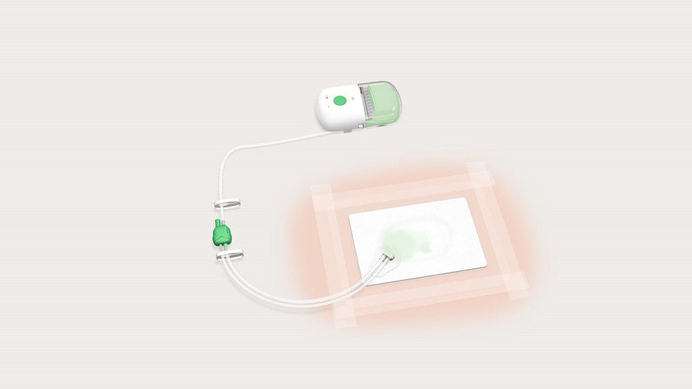 Avance Solo Negative Pressure Wound Therapy With Dressing